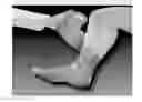 Fig. 01 - SYSTEM AND METHOD FOR TREATING LEG ULCERS
