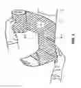 Fig. 02 - SYSTEM AND METHOD FOR TREATING LEG ULCERS