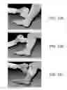 Fig. 09 - SYSTEM AND METHOD FOR TREATING LEG ULCERS