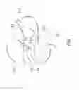 Fig. 02 - Intragastric device for treating obesity