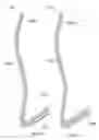 Fig. 49 - Intragastric device for treating obesity