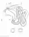 Fig. 07 - System and method for gastric restriction and malabsorption