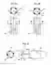 Fig. 04 - Detection and clearing of occlusions in catheters