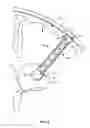 Fig. 03 - Devices, systems and methods for diverting fluid trapped in a solid organ