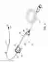 Fig. 02 - Catheter system