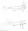 Fig. 02 - Perfusion catheter system for simultaneous delivery of cardioplegia to the left and right coronary artery