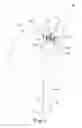 Fig. 02 - Socketed portal anchors and methods of using same