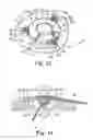 Fig. 07 - Socketed portal anchors and methods of using same