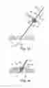 Fig. 09 - Socketed portal anchors and methods of using same