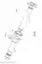 Fig. 07 - Sealing multiple surgical instruments
