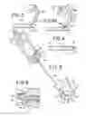 Fig. 04 - Devices and methods for treating bone tissue