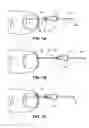 Fig. 02 - Method of treating infections, diseases or disorders of nail unit