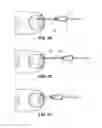Fig. 04 - Method of treating infections, diseases or disorders of nail unit