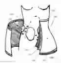 Fig. 02 - STRETCH MARK THERAPY AND MOISTURIZING GARMENT