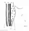 Fig. 03 - STRETCH MARK THERAPY AND MOISTURIZING GARMENT
