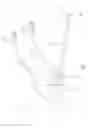 Fig. 02 - Cardiotomy suction tube system with multiple tips