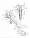 Fig. 02 - Retention Cuff for Bowel Management System
