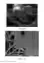 Fig. 12 - Absorbent articles with nonwoven substrates having fibrils