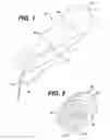 Fig. 02 - Tampon having spirally shaped grooves