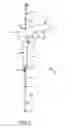 Fig. 02 - Method and apparatus for placing a cannula in a bladder