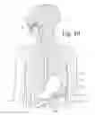 Fig. 08 - Device for selectively reducing absorption of unhealthy food