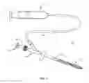 Fig. 02 - Device for performing a surgical procedure and method