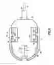 Fig. 07 - Automatic angled infusion set assembly