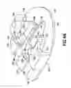 Fig. 45 - Automatic angled infusion set assembly
