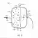 Fig. 03 - Infusion system for the controlled delivery of therapeutic agents