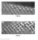 Fig. 03 - Microarray for delivery of therapeutic agent and methods of use