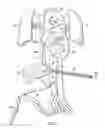 Fig. 06 - Fetal intervention using magnetically-guided navigation