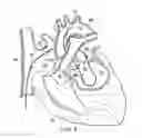 Fig. 07 - Fetal intervention using magnetically-guided navigation