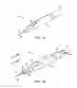 Fig. 02 - Methods and systems for treatment of spasticity