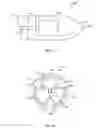Fig. 07 - Mechanically heated catheter