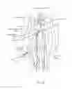 Fig. 03 - Direct Heat Ablation Catheter