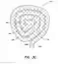 Fig. 06 - Intrauterine treatment device with articulating array