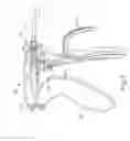 Fig. 07 - Electrosurgical instrument with restricted trigger