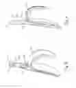 Fig. 09 - Electrosurgical instrument with restricted trigger