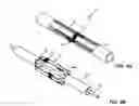 Fig. 05 - Mediguide-enabled renal denervation system for ensuring wall contact and mapping lesion locations