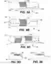 Fig. 09 - Mediguide-enabled renal denervation system for ensuring wall contact and mapping lesion locations