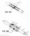 Fig. 10 - Mediguide-enabled renal denervation system for ensuring wall contact and mapping lesion locations