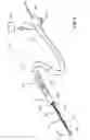 Fig. 02 - Feedback systems and methods for renal denervation utilizing balloon catheter