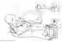 Fig. 01 - Force feedback device and method for catheters