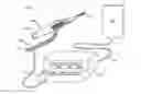 Fig. 01 - Electrosurgical instrument