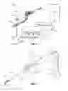 Fig. 02 - Electrosurgical instrument