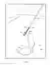 Fig. 16 - Flexible RF ablation needle