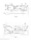 Fig. 12 - Combination electrosurgical device