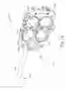 Fig. 15 - Electrosurgical device with disposable shaft having clamshell coupling