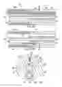 Fig. 03 - Catheter with needles for ablating tissue layers in vessel