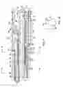 Fig. 05 - Catheter with needles for ablating tissue layers in vessel